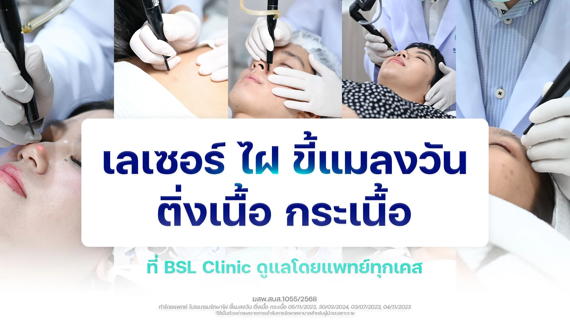 เลเซอร์ไฝ ติ่งเนื้อ กระเนื้อ CO2